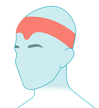 Tension Headaches