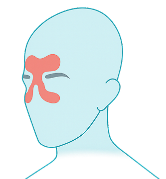 Sinus Pressure